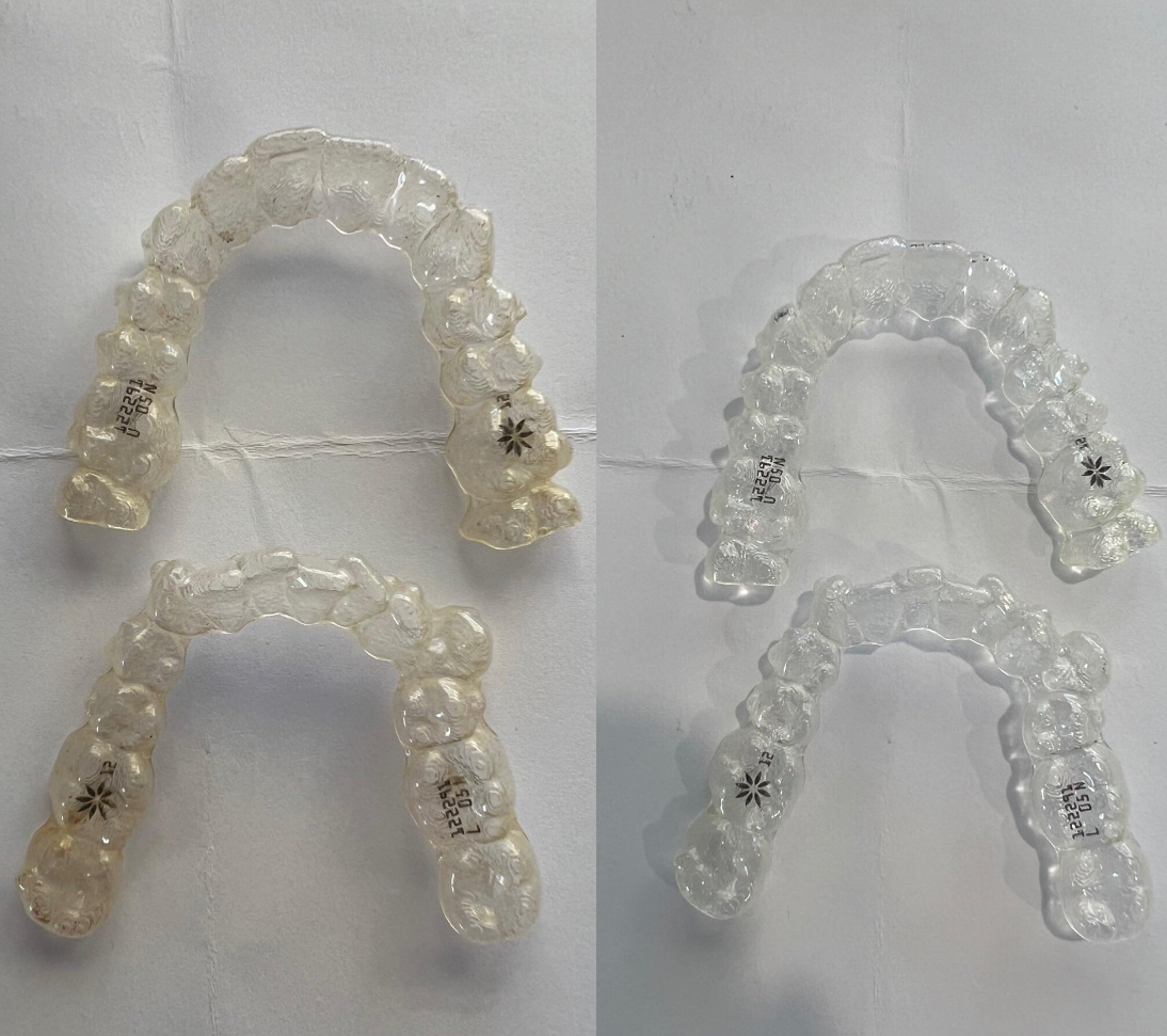 CleanTeethClub® Ultrasonic Retainer Cleaner