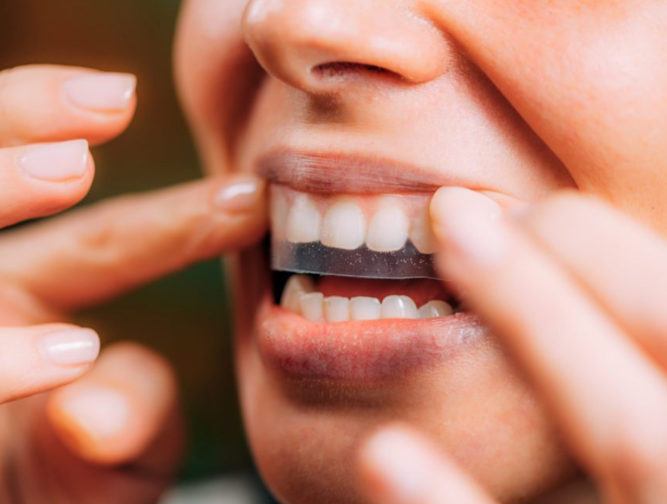 CleanTeethClub® Original 5D Whitening Strips